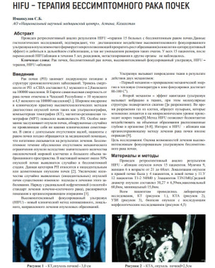 HIFU – ТЕРАПИЯ БЕССИМПТОМНОГО РАКА ПОЧЕК