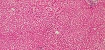 human_liver