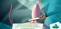 17.02. Миома